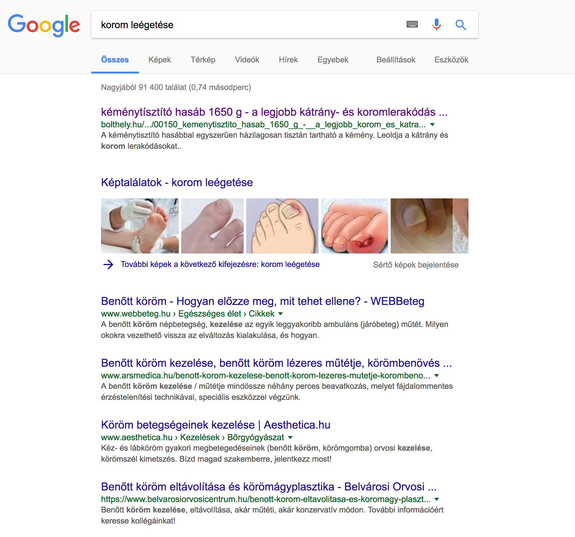 internetes találat az acc-hez